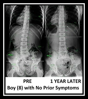 Testimonial Xray Elias B