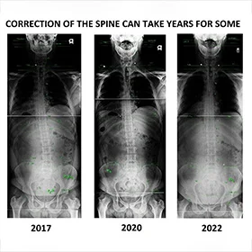 Testimonial Xray