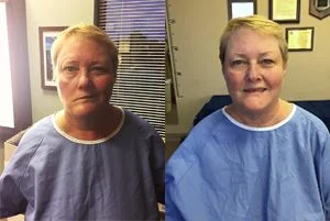 Testimonial Mary A before and after