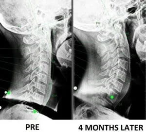 Testimonial neck xray improvement