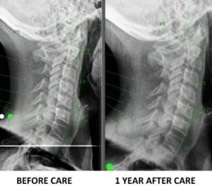 Testimonial neck xray