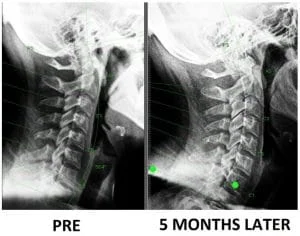 Testimonials xray improvement