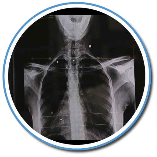 5 Components of The Gonstead Technique - Chiropractor Weldon